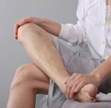 Southwest Vein and Leg Sclerotherapy Treatment